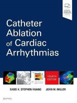 CATHETER ABLATION OF CARDIAC ARRHYTHMIAS