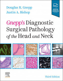 GNEPP´S DIAGNOSTIC SURGICAL PATHOLOGY OF HEAD AND NECK