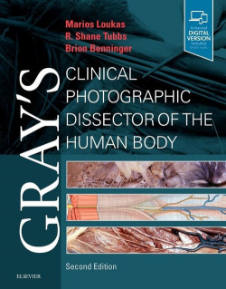 Gray's clinical photographic dissector of the human body