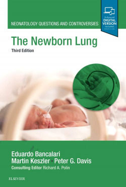THE NEWBORN LUNG