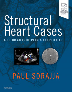 STRUCTURAL HEART CASES.(A COLOR ATLAS OF PEARLS AND PITFALLS