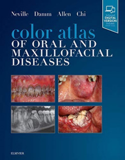 COLOR ATLAS OF ORAL AND MAXILLOFACIAL DISEASES