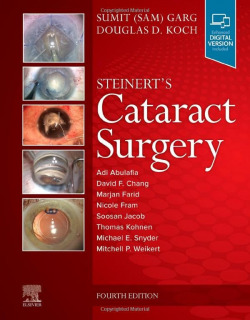 Steinert's cataract surgery
