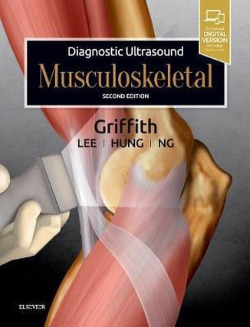 DIAGNOSTIC ULTRASOUND MUSCULOSKELETAL