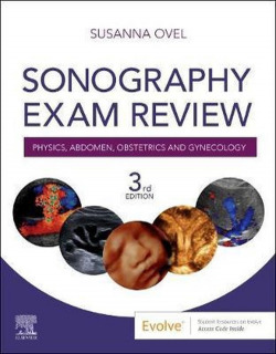 SONOGRAPHY EXAM REVIEW
