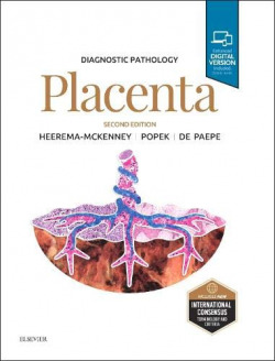 DIAGNOSTIC PATHOLOGY:PLACENTA 2ND EDITION