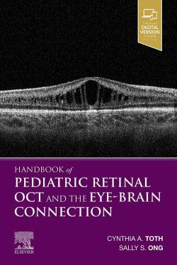HANDBOOK OF PEDIATRIC RETINAL OCT THE EYE-BRAIN CONNECTION