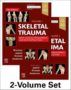 SKELETAL TRAUMA
