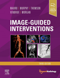 Image-guided interventions