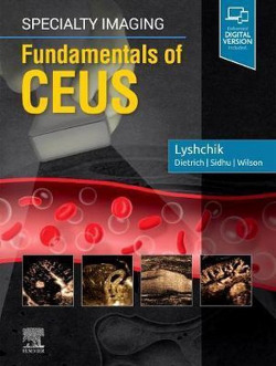 SPECIALTY IMAGING FUNDAMENTALS OF CEUS