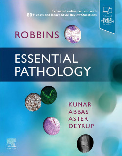 Robbins essential pathology