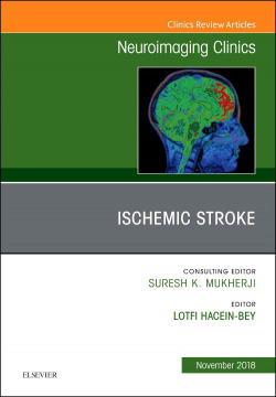 ISCHEMIC STROKE, AN ISSUE OF NEUROIMAGING CLINICS NORTH AMERICA