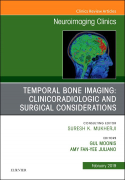 TEMPORAL BONE IMAGING