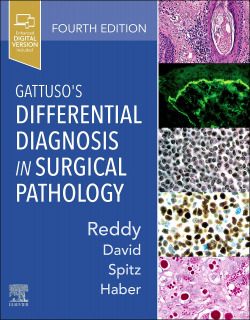 Gattuso's differential diagnosis in surgical pathology
