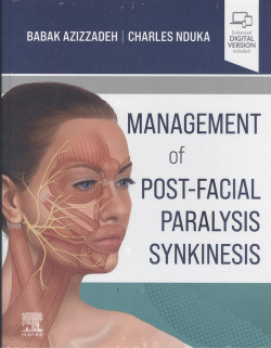 MANAGEMENT OF POST-FACIAL PARALYSIS SYNKINESIS