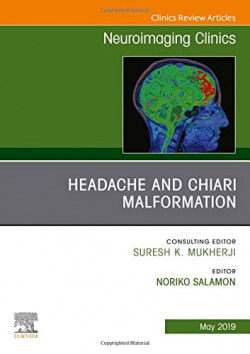 HEADACHE AND CHIARI MALFORMATION
