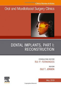 DENTAL IMPLANTS, PART I