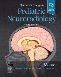 Diagnostic imaging:pediatric neuroradiology