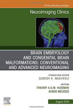 BRAIN EMBRYOLOGY AND CAUSE CONGENITAL MALFORMATIONS