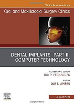 DENTAL IMPLANTS, PART II