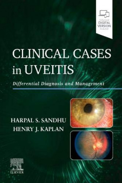Clinical cases in uveitis