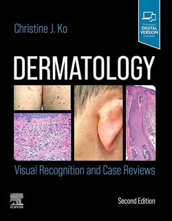 Dermatology:visual recognition and case reviews