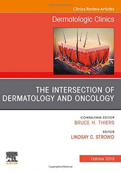 Intersection of dermatology and oncology, issue dermatologi