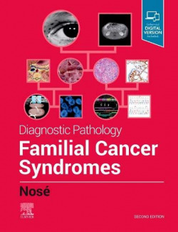 Diagnostic pathology:familial cancer syndromes