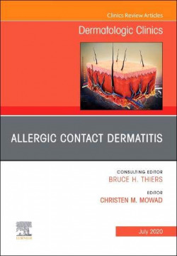 Allergic contact dermatitis
