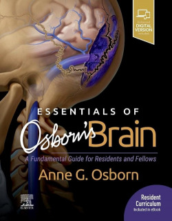 ESSENTIALS OF OSBORN'S BRAIN (DUO)