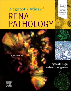 Diagnostic atlas of renal pathology