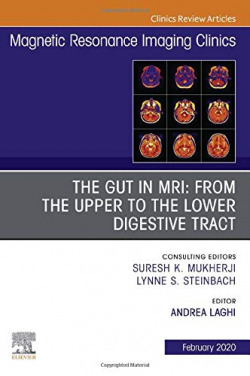 Mr imaging of the bowel
