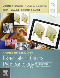 NEWMAN AND CARRANZA'S ESSENTIALS OF CLINICAL PERIODONTOLOGY
