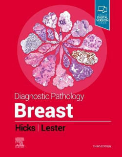 DIAGNOSTIC PATHOLOGY: BREAST