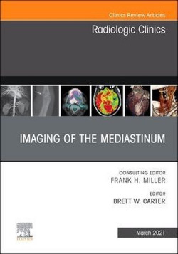 Imaging of the mediastinum