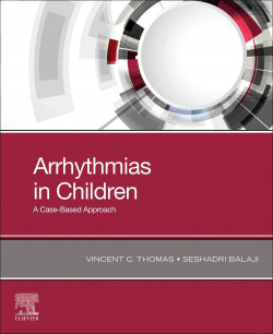 Arrhythmias in children