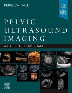 Pelvic ultrasound imaging