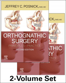 Orthognathic surgery