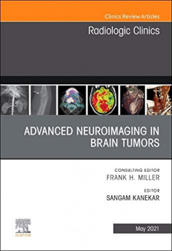 Advanced neuroimaging in brain tumors