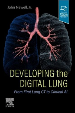 Developing the digital lung:from first lung ct to clinical