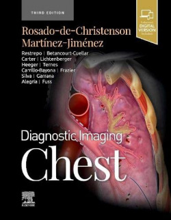 Diagnostic imaging:chest