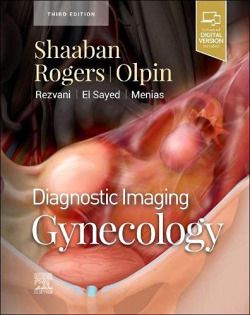 DIAGNOSTIC IMAGING:GYNECOLOGY