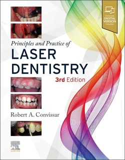 PRINCIPLES AND PRACTIVE OF LASER DENTISTRY 3RD.EDITION