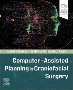 Computer-assisted planning in craniofacial surgery