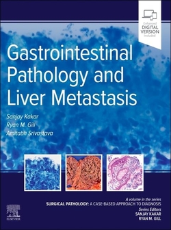 GASTROINTESTINAL PATHOLOGY AND LIVER METASTASIS