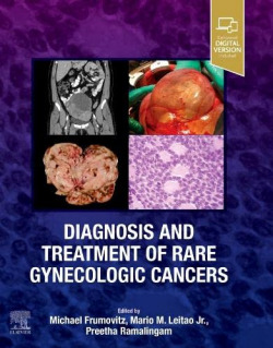 Diagnosis and tratment of rare gynecologic cancers