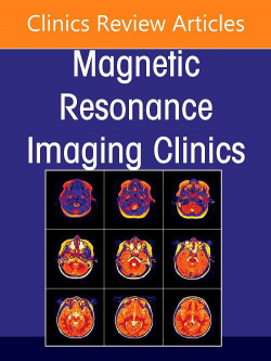 Mr imaging of head and neck cancer