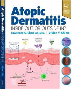 ATOPIC DERMATITIS:INSIDE OUT OR OUTSIDE IN