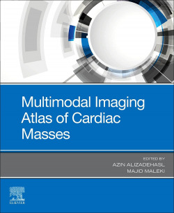 Multimodal imaging atlas of cardiac masses