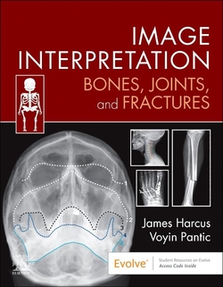 Image interpretation:bones, joints, and fractures